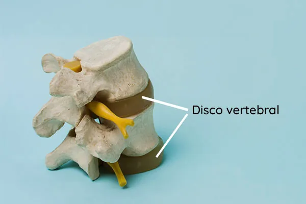 Imagen de dos vértebras y sus discos vertebrales